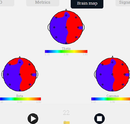 Software per l’elaborazione di segnali neurologici